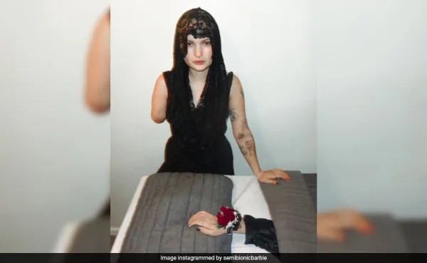 US Influencer Holds Funeral for Her Amputated Arm After Battling Rare Cancer
